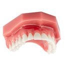 DentXpin Bulk Kit 100/Pk