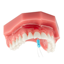 DentXpin Intro Kit 10/Pk
