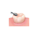 NTI Diamond FG 5/Pk