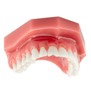 DentXpin Standard Kit 40/Pk