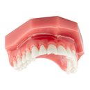 DentXpin Bulk Kit 100/Pk