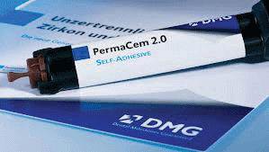 PermaCem 2.0 Smartmix Kit 9gm Syringe, Mixing Tips