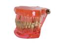 Dental Models Educational Restoration Model w/Implant