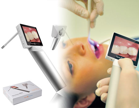 SyncVision iO1 Intraoral Camera Smart Pk